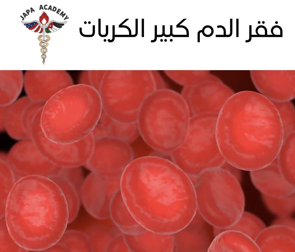 فقر الدم كبير الكريات فقر الدم بنقص فيتامين ب12 أو نقص الفوليت (فَقْرُ الدَّمِ ضَّخْمُ الأَرومات)